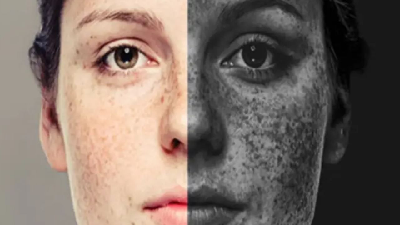 Skin Care Tips सोयाबीनचे तेल त्वचेला लावा आणि 'या' समस्या दूर करा