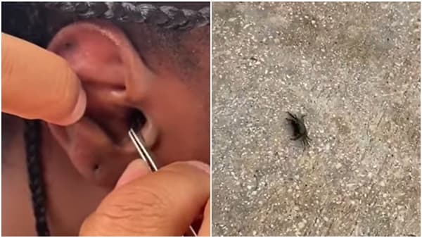 समुद्रात पोहत होती, तेवढ्यात कानात घुसला जिवंत खेकडा! Video viral