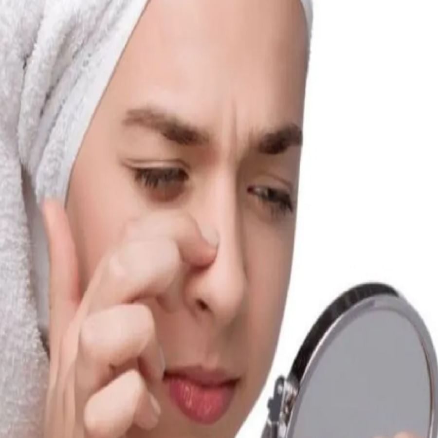 चेहऱ्यावरील खड्डे : चेहऱ्यावरील खड्ड्यांमुळे मुरमांची समस्या निर्माण होते. यासाठी अननसाच्या पेस्टमध्ये थोडे दही मिसळून चेहऱ्यावर लावा. पॅक सुकल्यानंतर कोमट पाण्याने चेहरा धुवा.