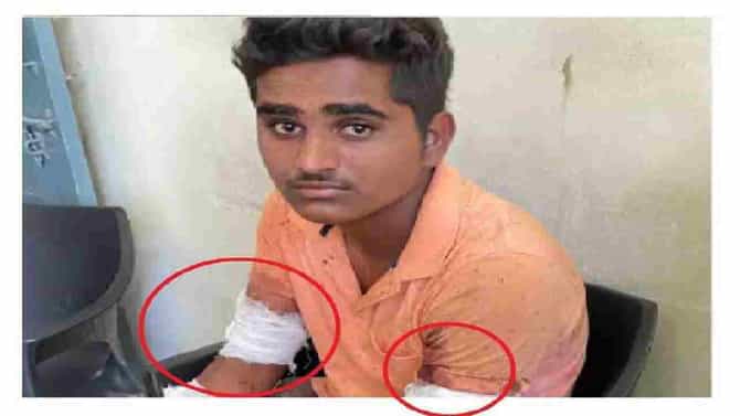Aurangabad | वाळूजमध्ये पुन्हा राडा, कामगाराला कोयत्याने मारहाण आणि लूट