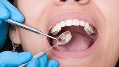 तोंडाच्या समस्यांकडे दुर्लक्ष कराल तर वाढेल ‘या’ आजारांचा धोका...