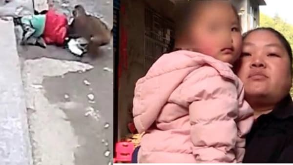 माकडाने केला लहनग्या जीवाववर जीवघेणा हल्ला, गोंडस चिमुकलीला गंभीर दुखापत