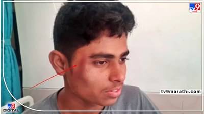 Pune Leopard attack : पुणे जिल्ह्यात बिबट्याचे हल्ले सुरूच, खेड आणि आंबेगावातल्या ग्रामस्थांवर केलेल्या हल्ल्यात दोन जखमी