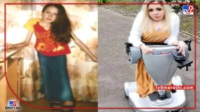 मागच्या तीस वर्षांपासून कधीही खाली न बसलेली स्टॅंडिंग वुमन, पोलंडची जोआना क्लिच दुर्धर आजाराने त्रस्त