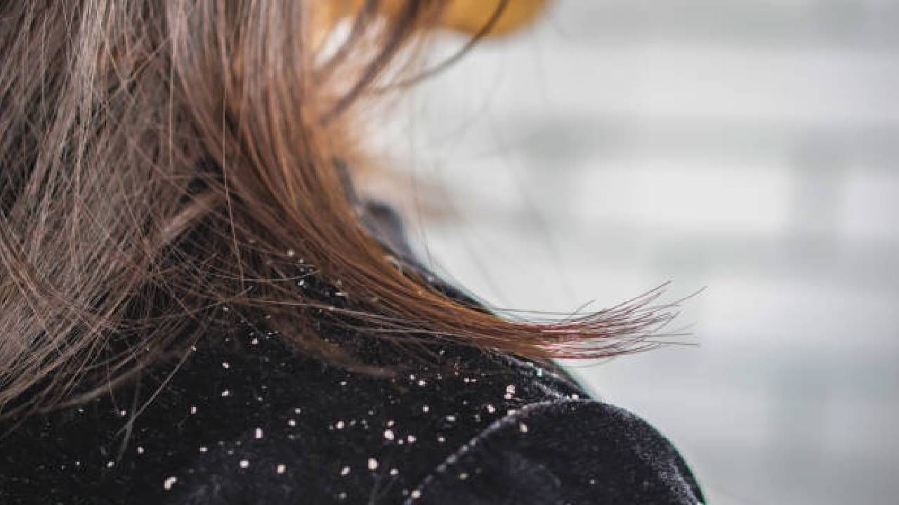 Hair Care Tips | कोंडयाचा त्रास दूर करण्यासाठी मेथीचे हे 3 हेअर मास्क फायदेशीर, वाचा अधिक!