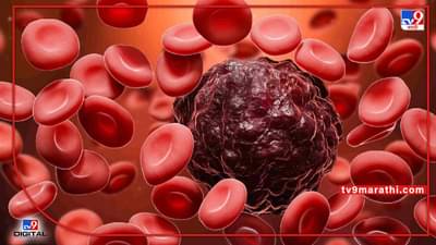 blood cancer : ‘बल्ड कॅन्सर’ झाल्यानंतर मुलांमध्ये दिसू लागतात ‘ही’ लक्षणे; हजारो मुले पडताय ‘ल्युकेमिया’ या आजाराला बळी जाणून घ्या, सविस्तर माहिती