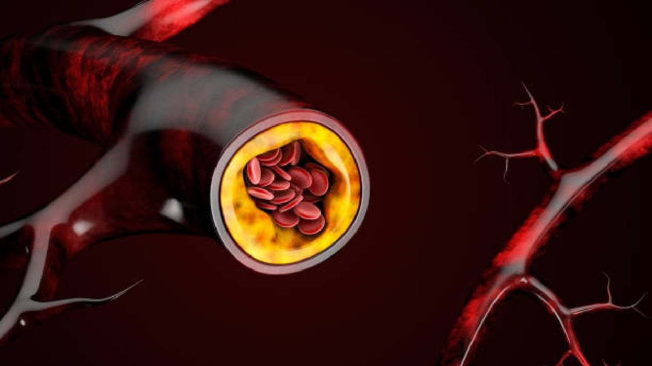 Health | कोलेस्ट्रॉलची पातळी वाढलीये? मग या गोष्टींचे सेवन करणे टाळाच... Health | कोलेस्ट्रॉलची पातळी वाढलीये? मग या गोष्टींचे सेवन करणे टाळाच...