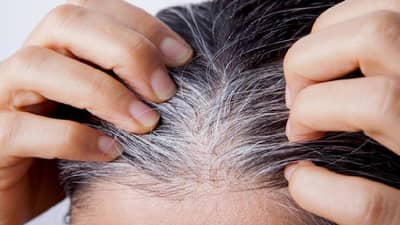 Hair | केस पांढरे होण्यापासून रोखण्यासाठी आहारात या खास आरोग्यदायी पदार्थांचा समावेश करा