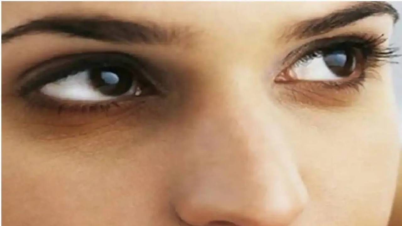 Dark circles : डोळयाभोवतीची काळी वर्तुळं करा दूर, जाणून घ्या आरोग्यविषयक खास टिप्स Dark circles : डोळयाभोवतीची काळी वर्तुळं करा दूर, जाणून घ्या आरोग्यविषयक खास टिप्स