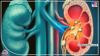 फक्त दारूच नाही तर ‘या’ गोष्टींनीही तुमचं लिव्हर होऊ शकते खराब! वेळीच व्हा सावध; लिव्हर निरोगी ठेवायचे असल्यास, या गोष्टी चुकूनही खाऊ नका