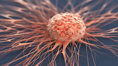 Cancer | वारंवार अन्न गरम करून खाणे आरोग्यासाठी अत्यंत धोकादायक, कॅन्सरचा धोका अधिक!