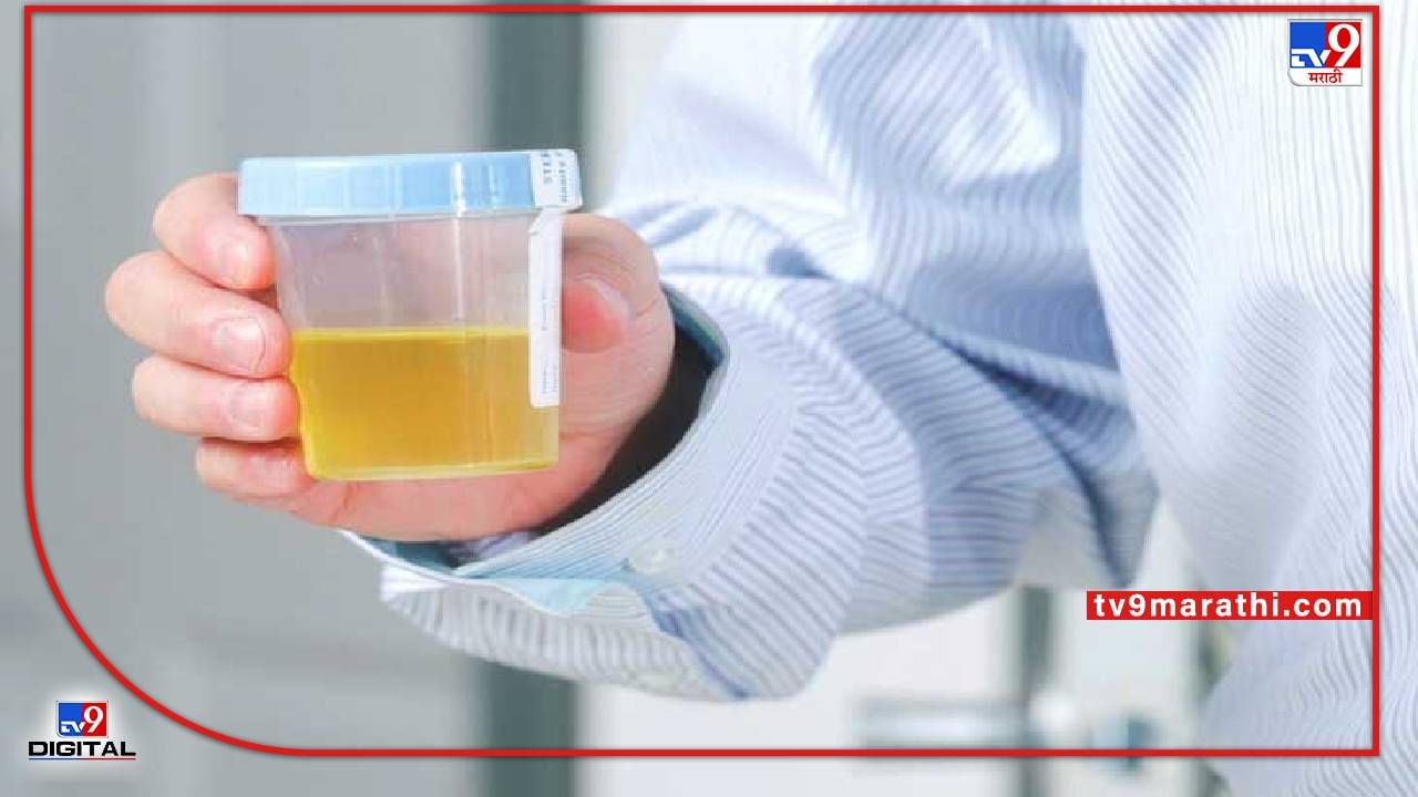 तुम्हालाही तुमच्या ‘युरीन’ मध्ये पांढरे कण दिसतात का? मग तुम्हाला ‘हे