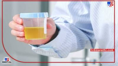 तुम्हालाही तुमच्या ‘युरीन’ मध्ये पांढरे कण दिसतात का? मग तुम्हाला ‘हे’ आजार असू शकतात; जाणून घ्या, काय आहेत कारणे आणि त्यावरील उपचार!