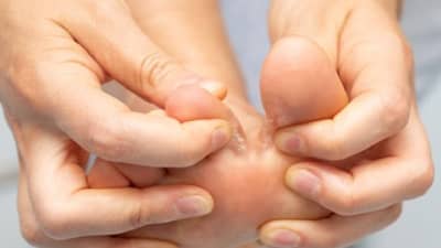 Diabetes | मधुमेहाच्या रूग्णांनी पायाच्या त्वचेची काळजी घेण्यासाठी या खास टिप्स फाॅलो कराव्यात!