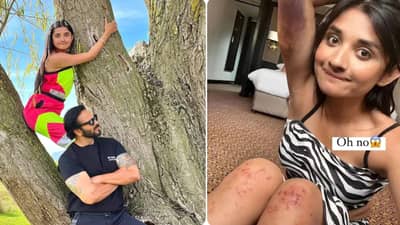 Khatron Ke Khiladi 12: खतरों के खिलाडी 12मध्ये स्टंट करताना अभिनेत्रीला दुखापत; पोस्ट केला फोटो