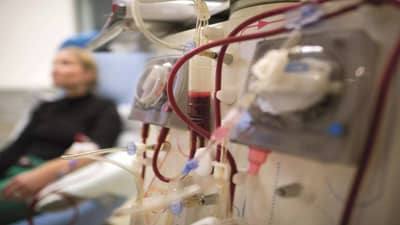 ‘डायलिसिस’ उपचारांबाबत लोकांनामध्ये अजुनही अनेक गैरसमज! जाणून घ्या, ‘डायलिसिस’ उपचाराची सत्य परिस्थिती!