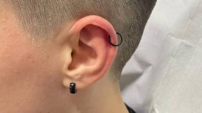 पावसाळ्यात का वाढतो ‘कानातील संसर्ग’..जाणून घ्या, त्यामागची कारणे लक्षणे आणि काही उपाय!