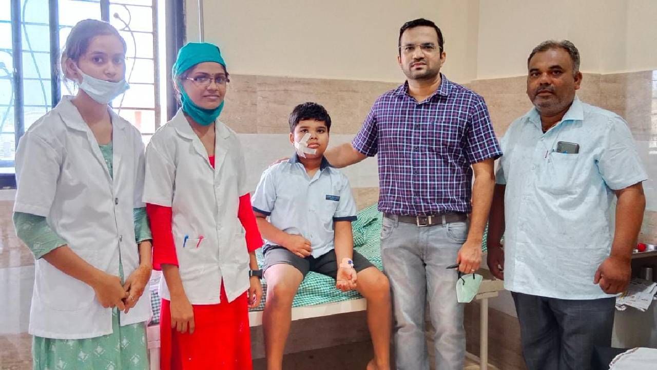 Chandrapur accident : चंद्रपुरात स्पार्कल मेणबत्तीचा स्फोट, 10 वर्षीय बालकाचे गाल, जीभ फाटली, 5 तास चालली शस्त्रक्रिया, यशस्वी प्लास्टिक सर्जरीने वाचला जीव