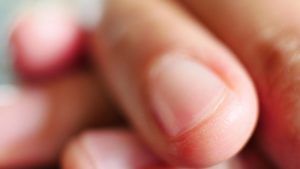 Nails: तुमची ‘नखं’ देतात गंभीर आजारांचे संकेत; ही लक्षणे दिसताच वेळीच व्हा सावध!