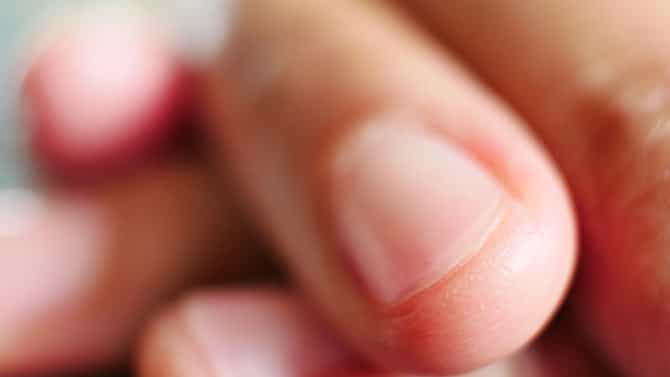 Nails: तुमची ‘नखं’ देतात गंभीर आजारांचे संकेत; ही लक्षणे दिसताच वेळीच व्हा सावध!