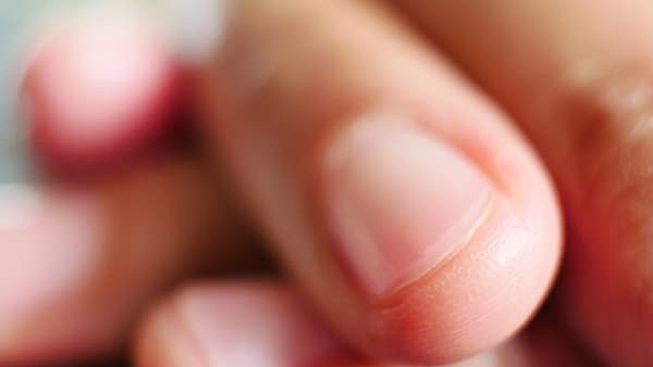 Nails: तुमची ‘नखं’ देतात गंभीर आजारांचे संकेत; ही लक्षणे दिसताच वेळीच व्हा सावध!