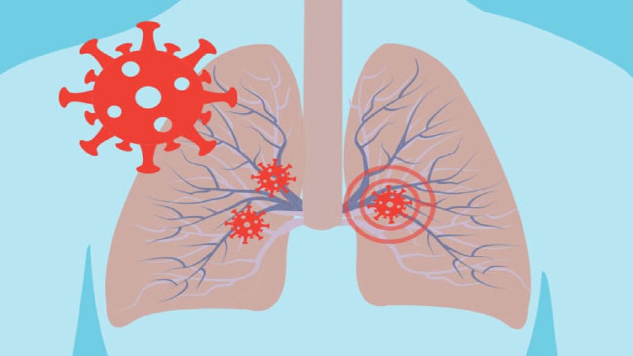 Lungs health : हवा प्रदूषणामुळे होतंय फुप्फुसांचे नुकसान, जाणून घ्या लक्षणे