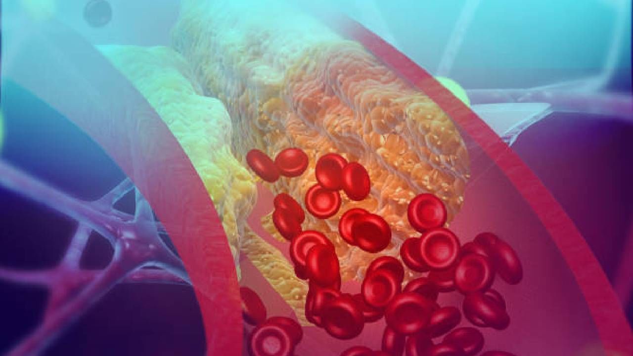 Cholesterol control Tips | तुम्हीही वाढलेल्या कोलेस्ट्रॉलच्या समस्येने त्रस्त आहात? मग या टिप्स फॉलो करा!