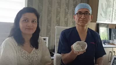 1 Kg Kidney Stone: तब्बल एक किलोचा मुतखडा, भारतातली पहिली मोठी शस्त्रक्रिया! इंडिया बुक, आशिया बुक ऑफ रेकॉर्डने घेतली दखल