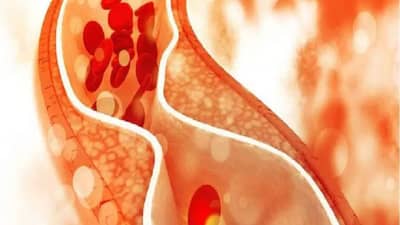 Health | कोलेस्ट्रॉल कमी करण्यासाठी या नैसर्गिक पेयांचा दररोजच्या आहारात नक्कीच समावेश करा आणि निरोगी राहा!