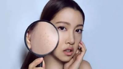 Dark Spots : जखमेमुळे त्वचेवर पडले काळे डाग ? हे उपाय करून पहा