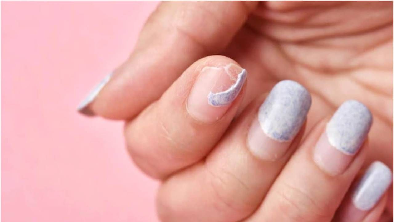 Brittle Nails: तुमची नखेही सहज तुटतात का? तर करा ‘या’ 5 गोष्टी नखे दिसतील अधिक सुंदर!