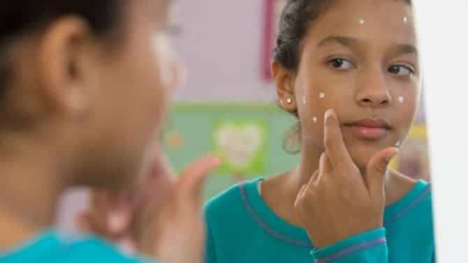 Cleanser : ‘या’ सर्वोत्कृष्ट क्लिंजरच्या सहाय्याने मुरुमांसह त्वचेची घ्या काळजी; अशा प्रकारे तयार करा घरच्या घरी क्लिंजर!