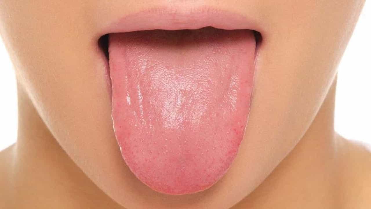 Vitamin Deficiency : जीभ अशी दिसत असेल तर समजा शरीरात आहे या व्हिटॅमिनची कमतरता