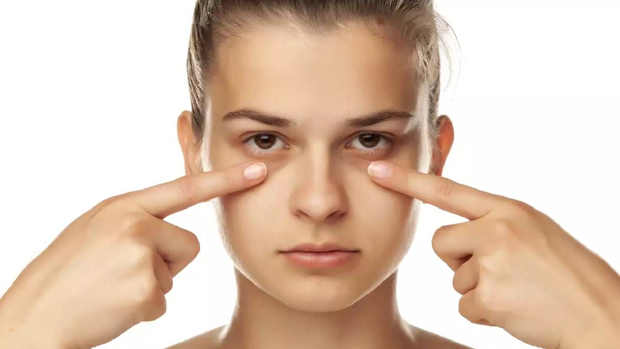 Dark Circles Removal: डाग सर्कलमुळे हैराण आहात? हे सहा उपाय करा अन् फरक अनुभवा...