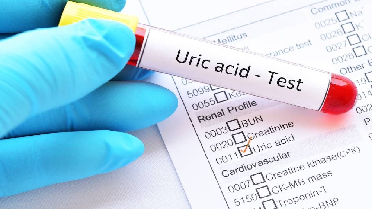 Tips To Control Uric Acid: युरिक ॲसिड वाढल्यास घाबरून नका, अशा पद्धतीने करा कंट्रोल !