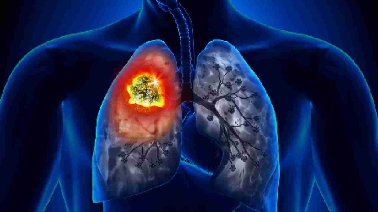 Lung Cancer: सिगरेट न पिणाऱ्यांनाही वाढतोय फुफ्फुसाच्या कर्करोगाचा धोका, काय आहे कारण?