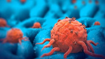 Cancer:  या  4 कारणांमुळे कमी वयातच होत आहे कर्करोग, तुम्हीही रहा सावध