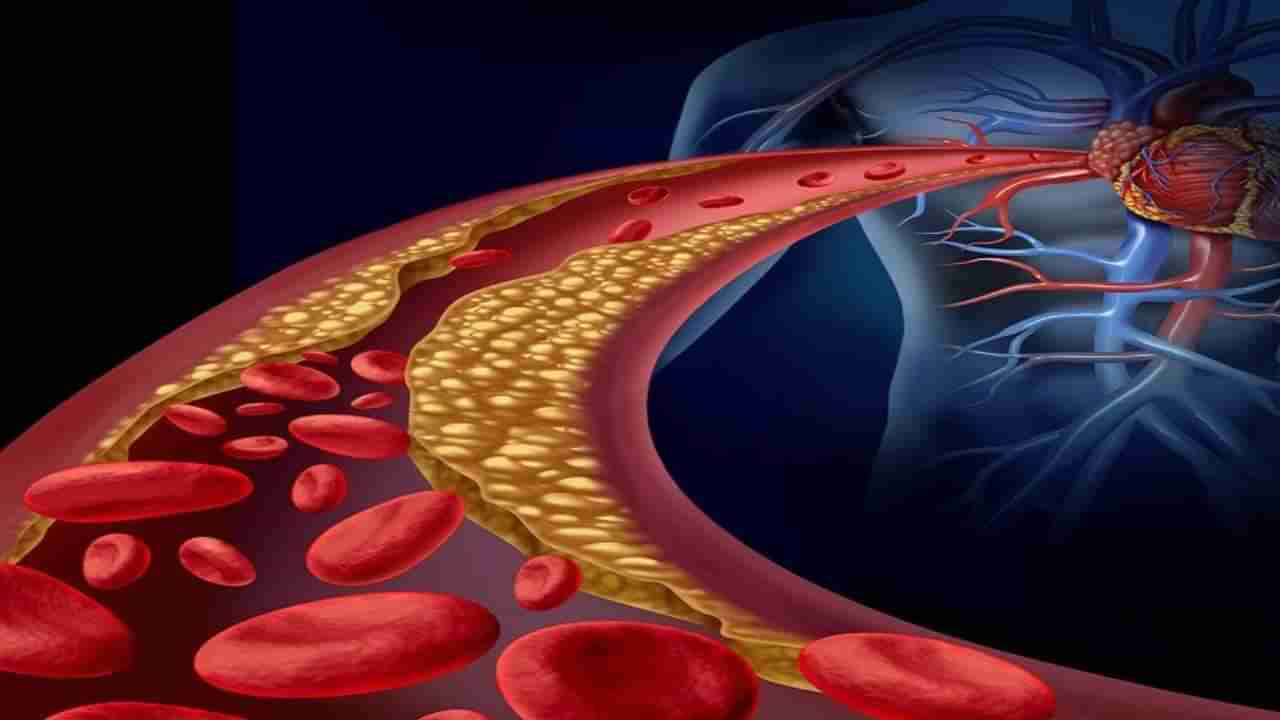 Exercise For Cholesterol: कोलेस्ट्रॉल कमी करण्यासाठी करा हे व्यायाम, मिळेल औषधांपेक्षाही जास्त फायदा