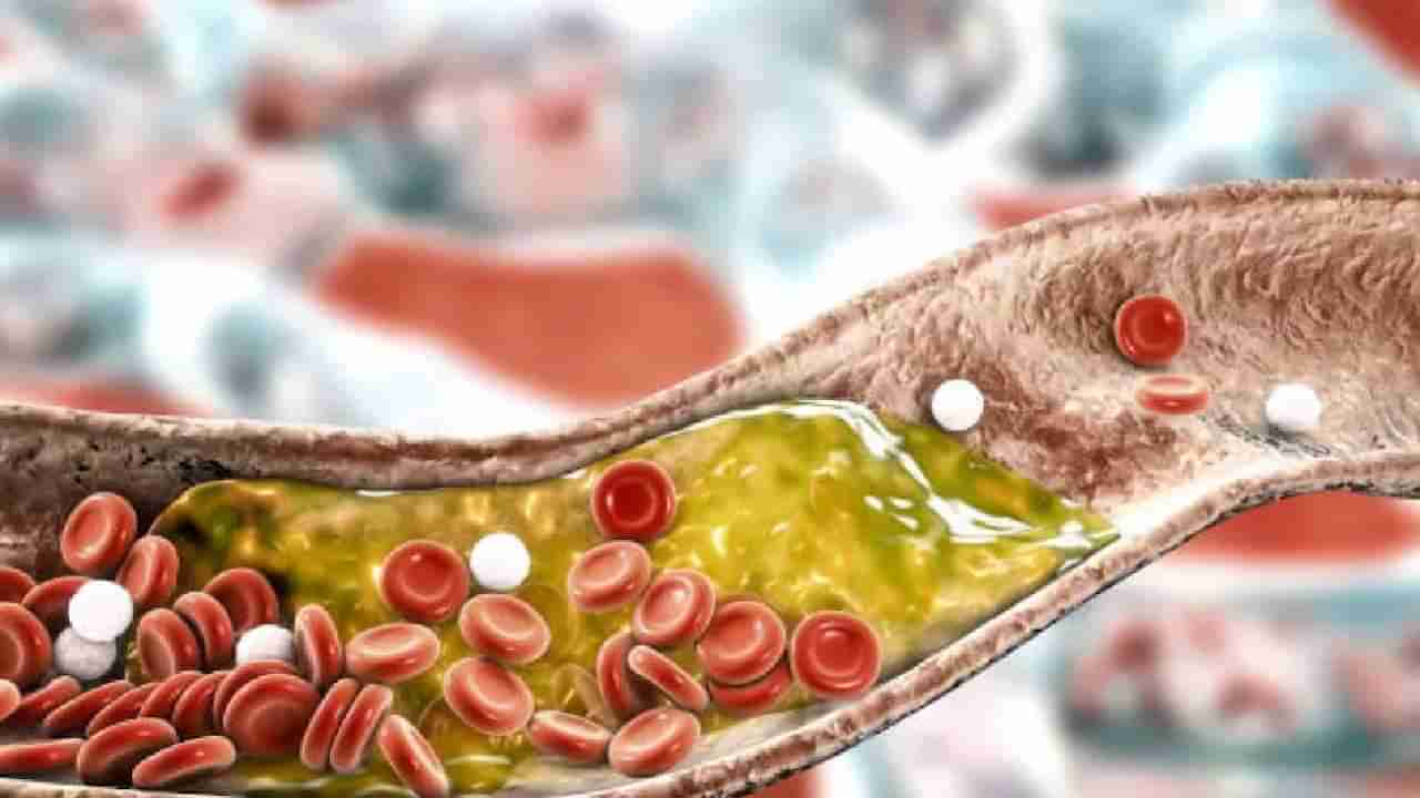 High Cholesterol: रक्तवाहिन्यांमधील खराब कोलेस्ट्रॉल विरघळतील या 5 गोष्टी, प्रत्त्येकाने नक्की खावे