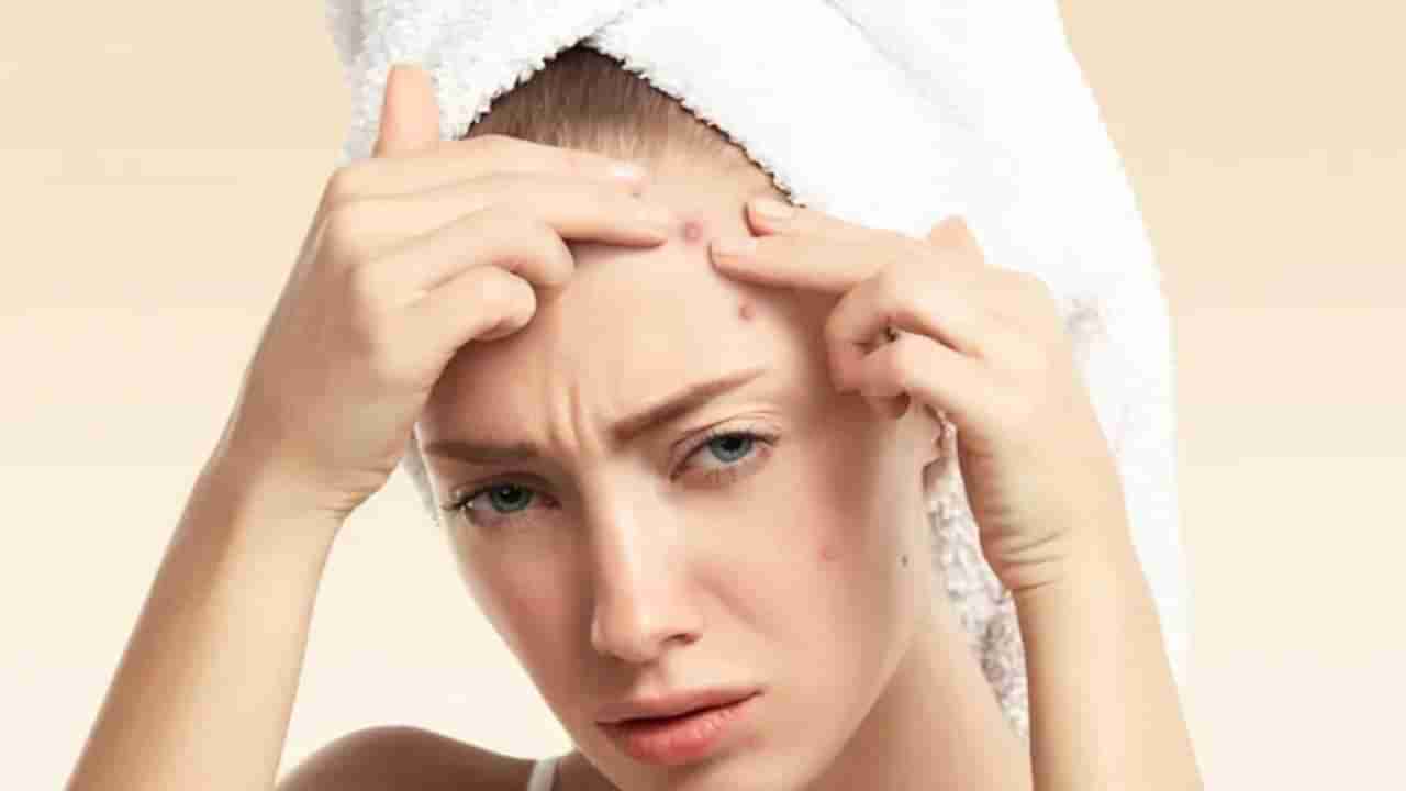 Beauty Tips: त्वचेसाठी धोकादायक ठरतात White Pimples! जाणून घ्या बचावाचे उपाय