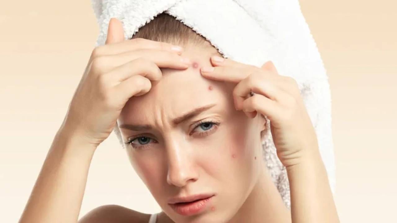 Beauty Tips: त्वचेसाठी धोकादायक ठरतात White Pimples! जाणून घ्या बचावाचे उपाय