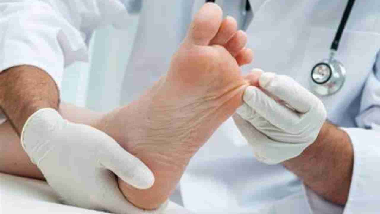 Diabetes Common Symptoms in Feet: ब्लड शुगर वाढल्याने पायांवर दिसू लागतात ही लक्षणे, करू नका दुर्लक्ष