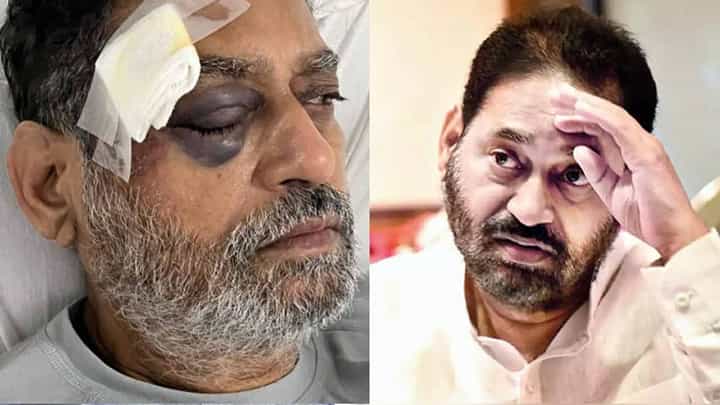 भारत जोडो यात्रेत अपघात कसा झाला? नितीन राऊत यांनी घटनाक्रम सांगितला... भारत जोडो यात्रेत अपघात कसा झाला? नितीन राऊत यांनी घटनाक्रम सांगितला...