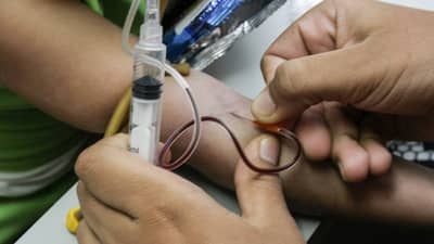 Iron deficiency causes: तुमच्या शरीरात लोहाची कमतरता आहे का ? अशी ओळखा लक्षणे