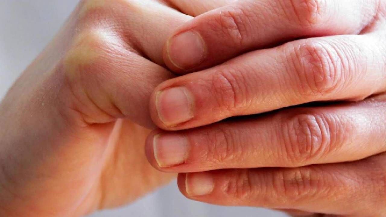 Health: हात देखील सांगतात तुमच्या आरोग्याची स्थिती, ही लक्षणे असू शकतात मोठ्या आजाराचे संकेत