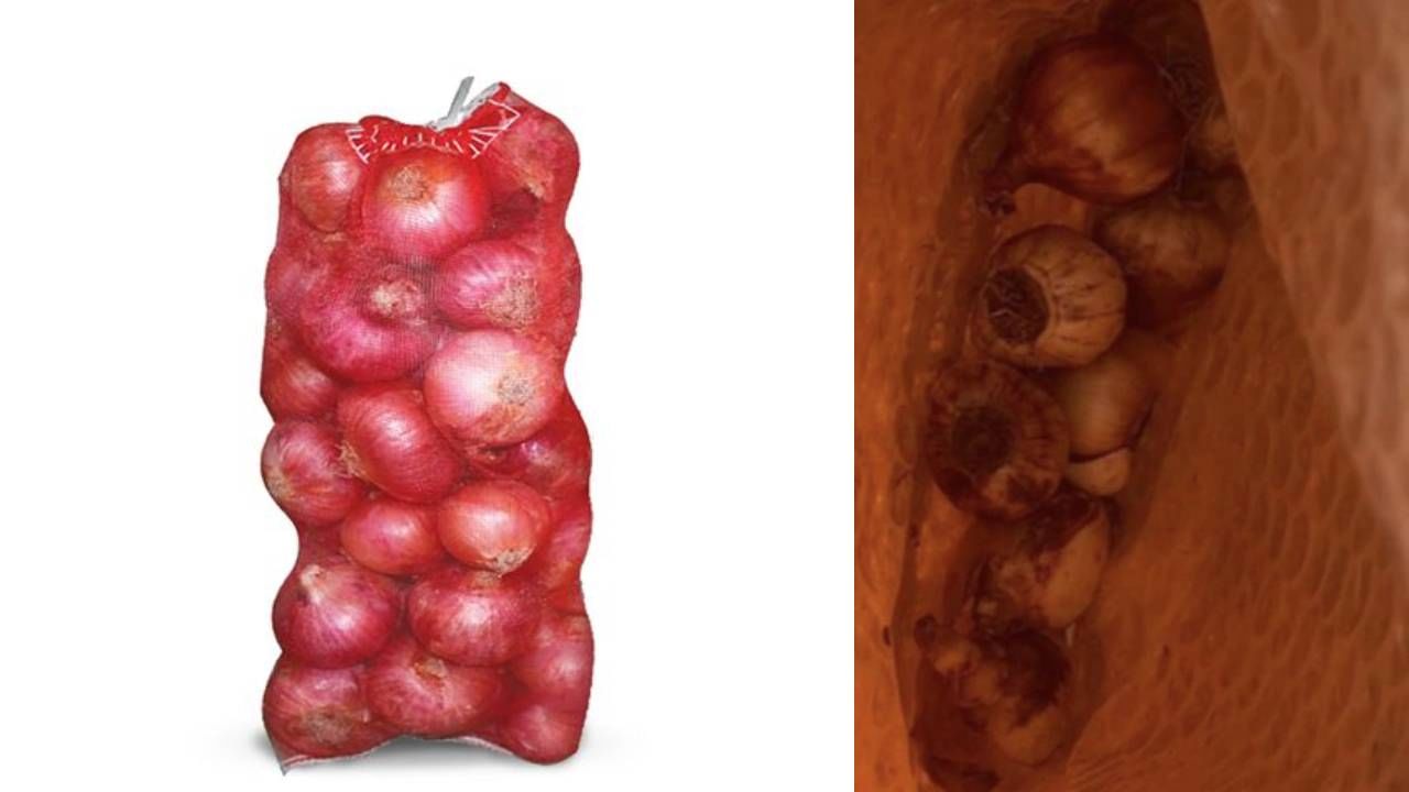 Online Jeans मागवली, कांद्याची पिशवी आली! या App वरून केली होती शॉपिंग Online Jeans मागवली, कांद्याची पिशवी आली! या App वरून केली होती शॉपिंग