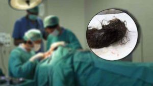 10 वर्षांच्या मुलीच्या पोटातून काढले तब्बल अर्धा किलो केस! किती वेळ चालली शस्त्रक्रिया? वाचा 