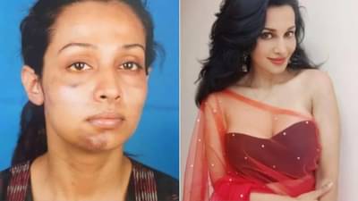 त्याने इतकं मारलं की जबडाच तुटला, जीवे मारण्याची दिली धमकी; अभिनेत्रीचा बॉयफ्रेंडवर आरोप