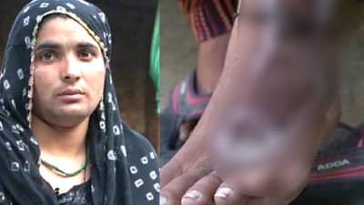 दुसऱ्या पत्नीपासून सुटका मिळवण्यासाठी पतीने केले हे भयानक कृत्य, पण म्हणतात ना देव तारी त्याला कोण मारी