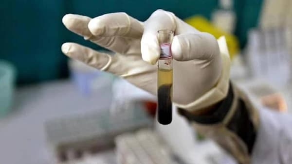घटस्फोट मिळवण्यासाठी पतीने रचला धक्कादायक कट; गरोदर पत्नीसोबत केले हे कृत्य